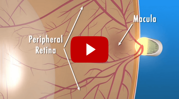 Age Related Macular Degeneration Facts (Explainer video.)